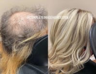 image description not provided by submitter