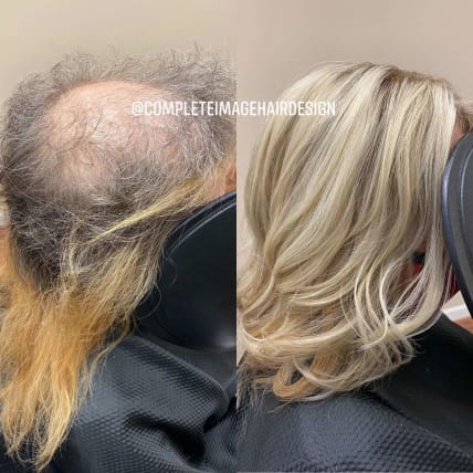 image description not provided by submitter