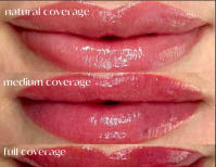 image description not provided by submitter