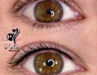 image description not provided by submitter