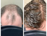 image description not provided by submitter